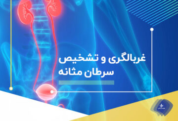 علائم و روش تشخیص سرطان مثانه