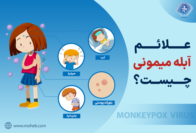 آشنایی کامل با آبله میمونی